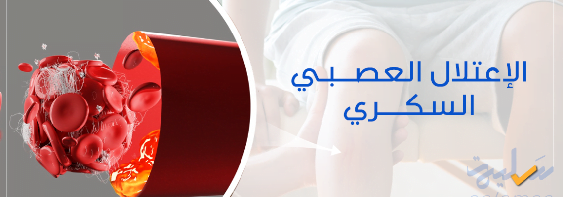 كيف يؤثر الاعتلال العصبي السكري على حياتك؟ اكتشف الحلول الفعّالة
