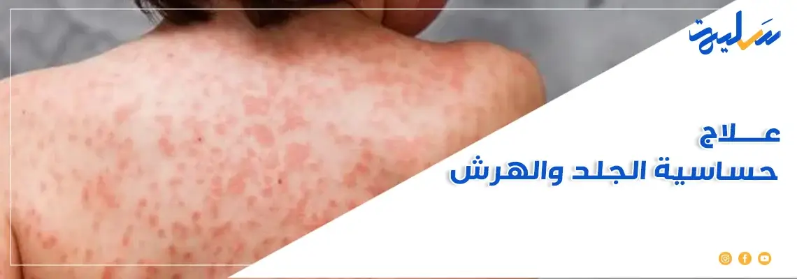 هل تعاني من حساسية الجلد والهرش؟ اكتشف أفضل الوسائل لتخفيف الأعراض بسرعة!