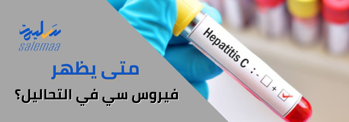 متى يظهر فيروس سي في التحاليل؟