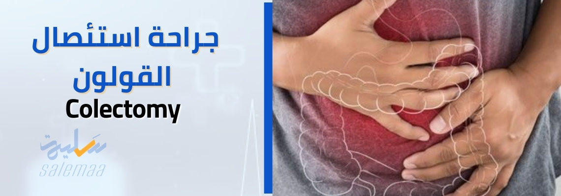 جراحة استئصال القولون Colectomy
