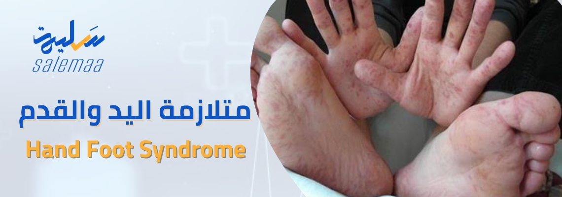 متلازمة اليد والقدم