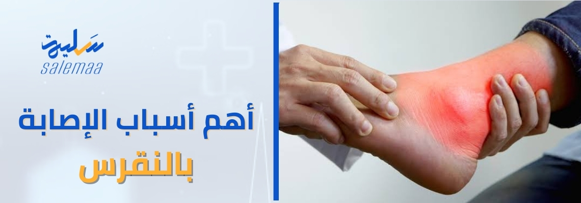 أهم أسباب الإصابة بالنقرس