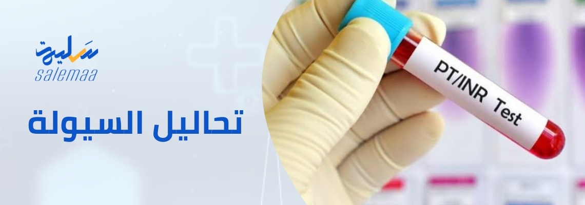 هل تعلم؟ تحاليل السيولة قد تكشف عن العديد من الأمراض المخفية!