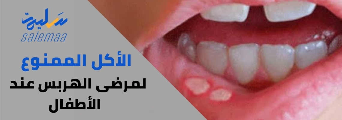 الأكل الممنوع لمرضى الهربس عند الأطفال