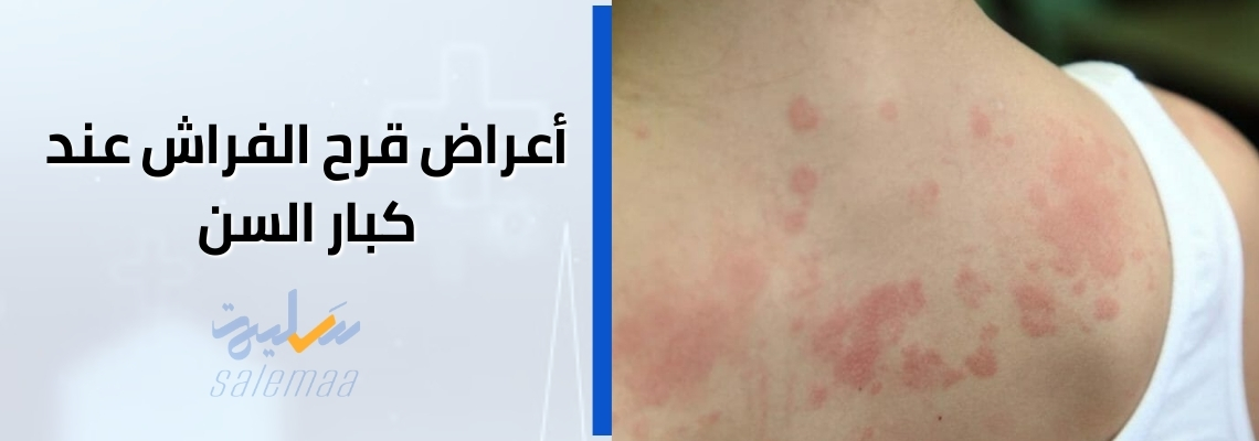 اعراض قرح الفراش عند كبار السن