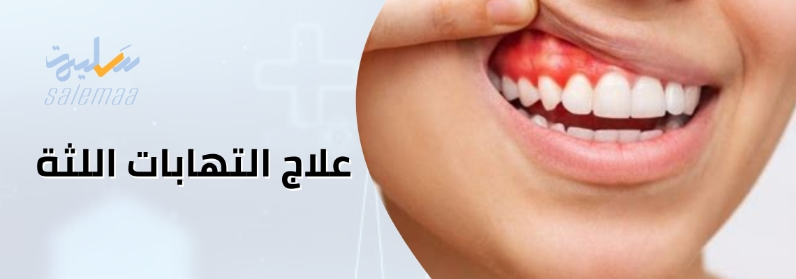 علاج التهابات اللثة