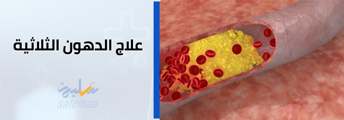 علاج الدهون الثلاثية