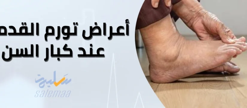 أعراض تورم القدمين عند كبار السن 