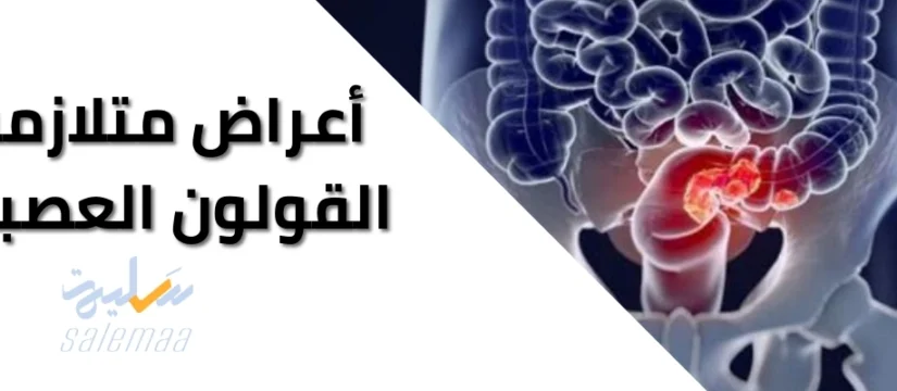 الأعراض المميزة لمتلازمة القولون العصبي Irritable Bowel Syndrome 