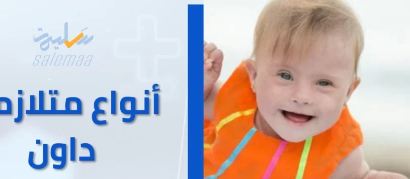 أنواع متلازمة داون