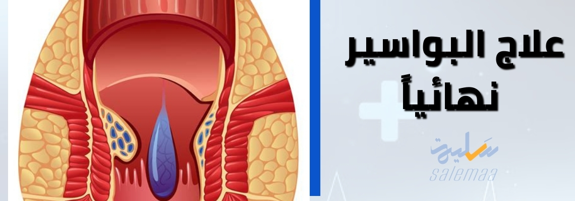 “انتهى العذاب: اكتشف العلاج الذي يضع نقطة نهائية للبواسير!”