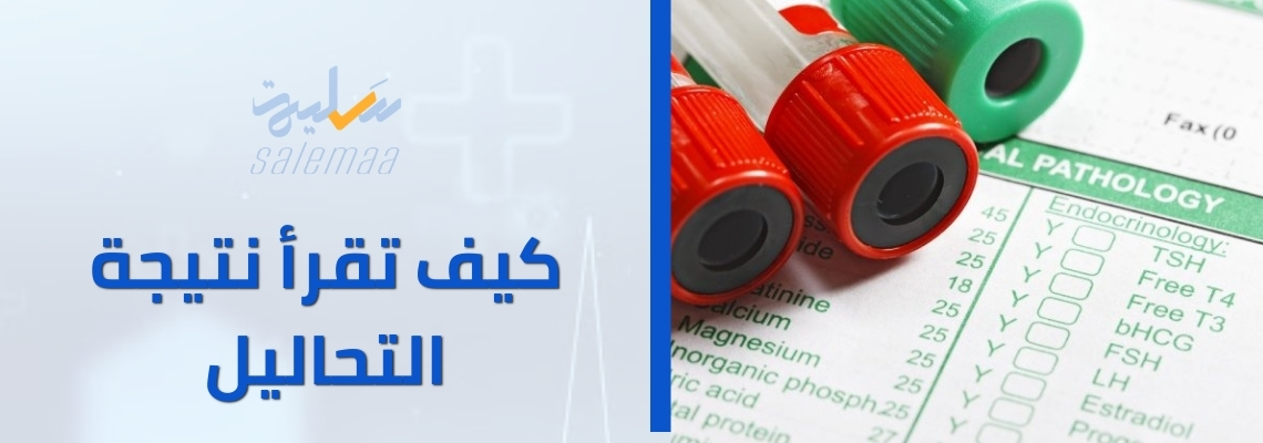 كيف تقرأ نتيجة التحاليل