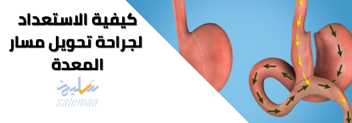 كيفية الاستعداد لجراحة تحويل مسار المعدة