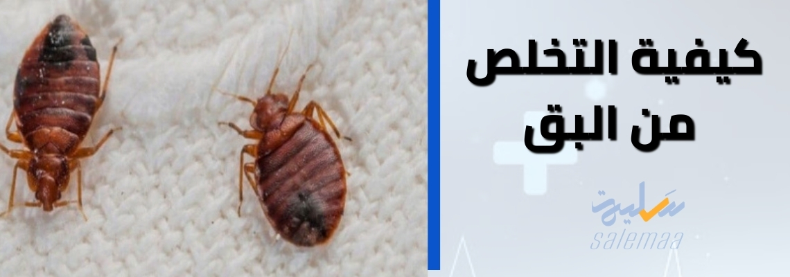 كيفية التخلص من البق