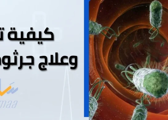 كيفية تشخيص وعلاج جرثومة المعدة