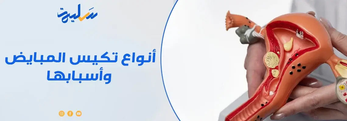 أنواع تكيس المبايض، وأسبابها