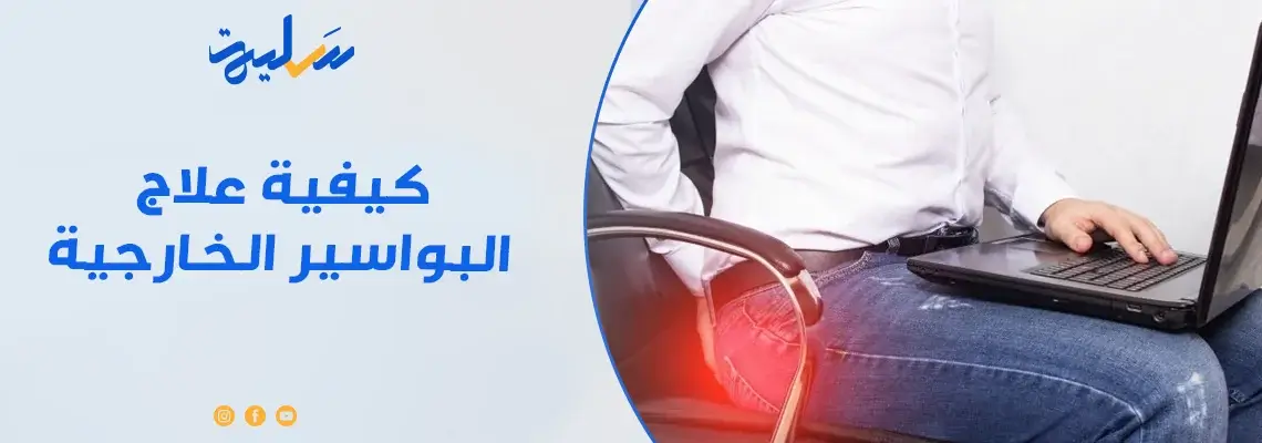 اكتشف الطرق الطبيعية لعلاج البواسير الخارجية دون ألم أو جراحة