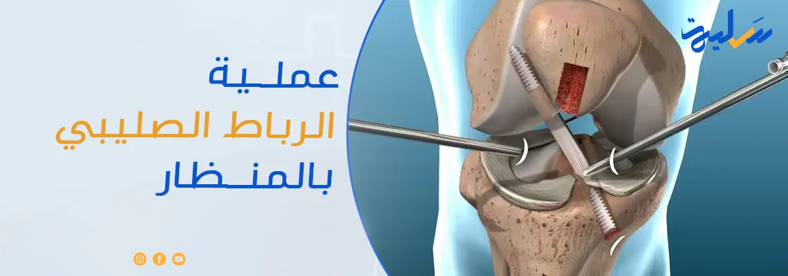 عملية الرباط الصليبي بالمنظار