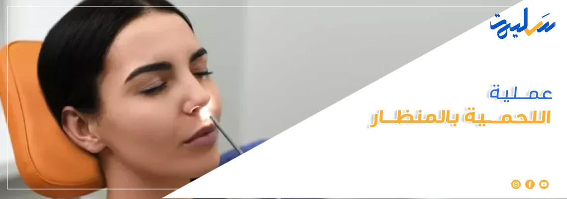 عملية اللحمية بالمنظار 