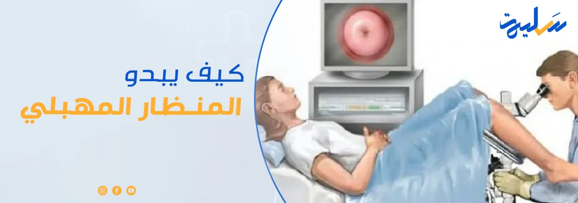 كيف يبدو المنظار المهبلي؟